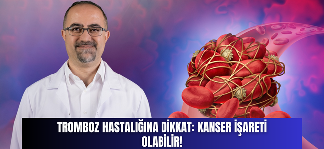 TROMBOZ HASTALIĞINA DİKKAT: KANSER İŞARETİ OLABİLİR!