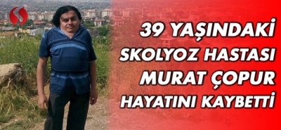 39 yaşındaki skolyoz hastası Murat Çopur hayatını kaybetti!