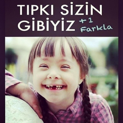 Bugün 21 Mart dünya Down Sendromu Farkındalık Günü