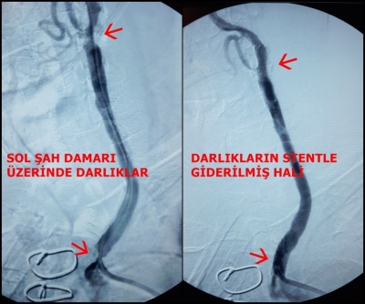 MEMLEKET GİBİSİ OLMAZ DEDİLER  FRANSA’DAN DENİZLİ TEKDEN HASTANESİ’NE GELDİLER